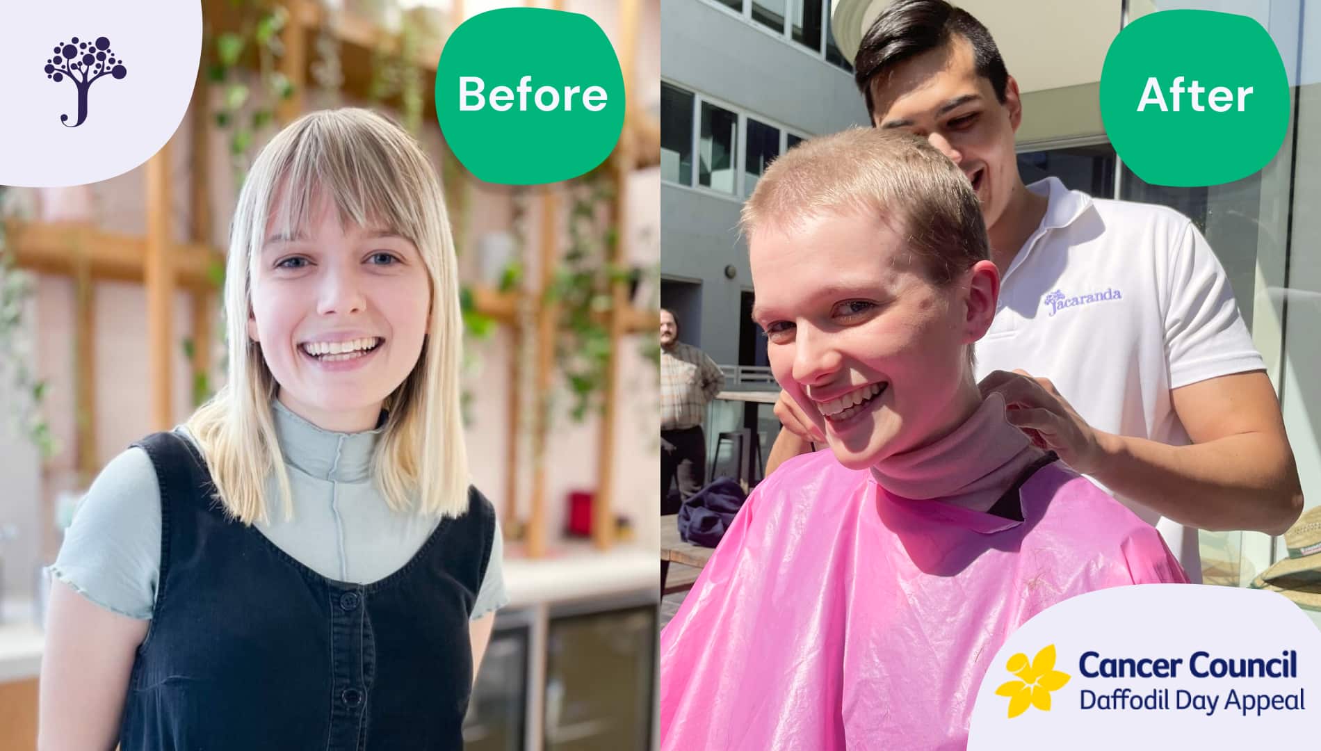 Daffodil Day before and after photo of Jemima Kelly